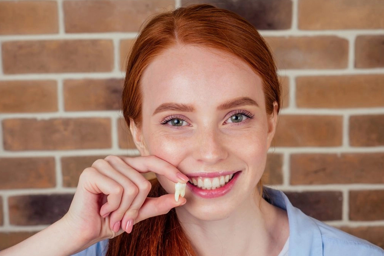 wisdom teeth removal Blacktown - westpoint dental clinic - blacktown